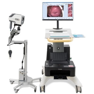 Colposcope – HD Optical Cervical Examination Microscope with LED