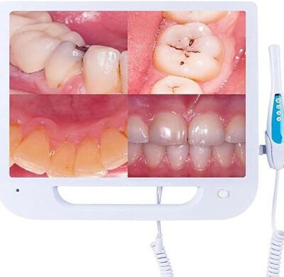 Dental Intraoral Camera with Monitor High Resolution Imaging, LED