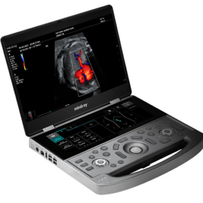 Mindray MX7 Ultrasound Unit – Portable Diagnostic System with ZST+